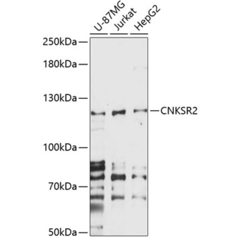 Western Blot - Anti-CNKR2 Antibody (A87985) - Antibodies.com