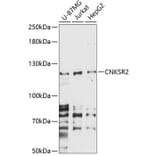 Western Blot - Anti-CNKR2 Antibody (A87985) - Antibodies.com