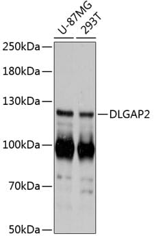Western blot analysis of extracts of various cell lines, using Anti-DLGAP2 Antibody (A13818) at 1:3000 dilution.
Secondary antibody: Goat Anti-Rabbit IgG (H+L) (HRP) (AS014) at 1:10,000 dilution.
Lysates / proteins: 25µg per lane.
Blocking buffer: 3% non-fat dry milk in TBST.
Detection: ECL Basic Kit (RM00020).
Exposure time: 1s.