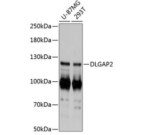 Western Blot - Anti-DLGAP2 Antibody (A87986) - Antibodies.com