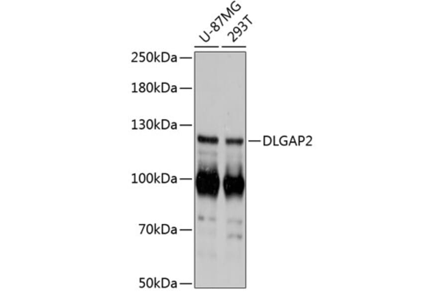 Western Blot - Anti-DLGAP2 Antibody (A87986) - Antibodies.com