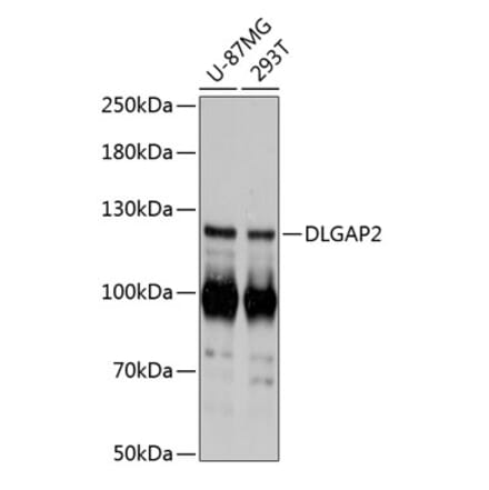 Western Blot - Anti-DLGAP2 Antibody (A87986) - Antibodies.com