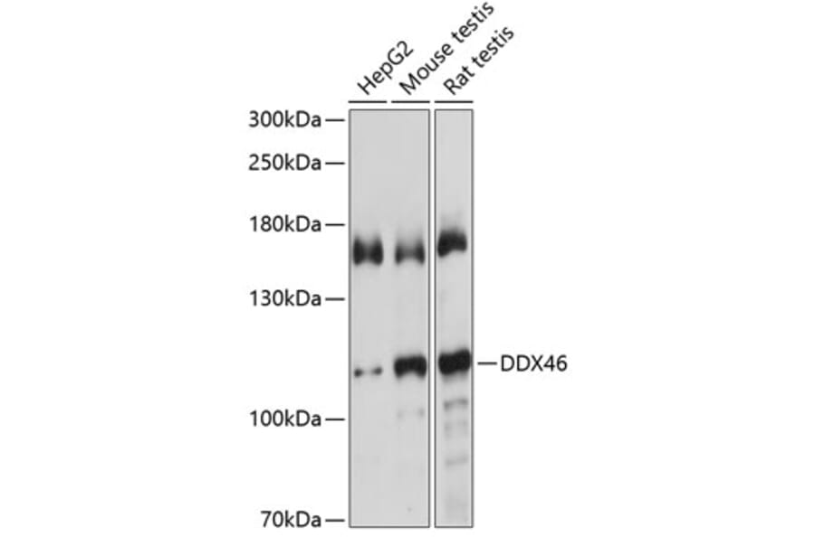 Western Blot - Anti-DDX46 Antibody (A87987) - Antibodies.com