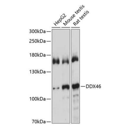 Western Blot - Anti-DDX46 Antibody (A87987) - Antibodies.com