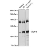 Western Blot - Anti-DDX46 Antibody (A87987) - Antibodies.com