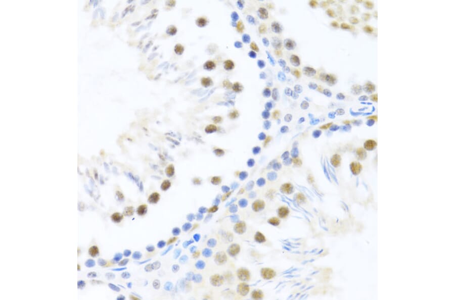 Immunohistochemistry - Anti-DDX46 Antibody (A87987) - Antibodies.com