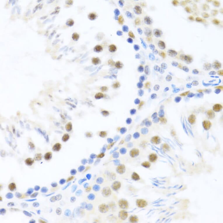 Immunohistochemistry - Anti-DDX46 Antibody (A87987) - Antibodies.com