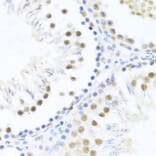 Immunohistochemistry - Anti-DDX46 Antibody (A87987) - Antibodies.com