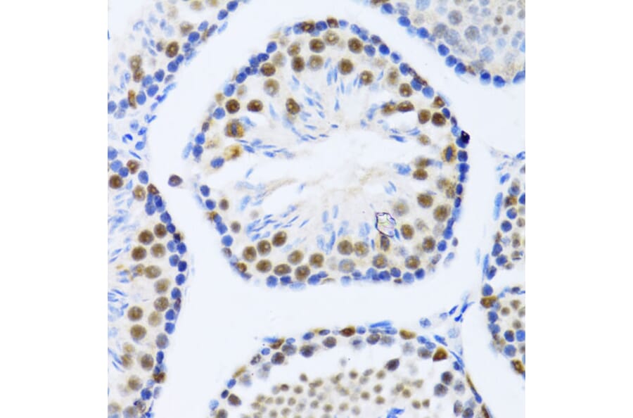 Immunohistochemistry - Anti-DDX46 Antibody (A87987) - Antibodies.com