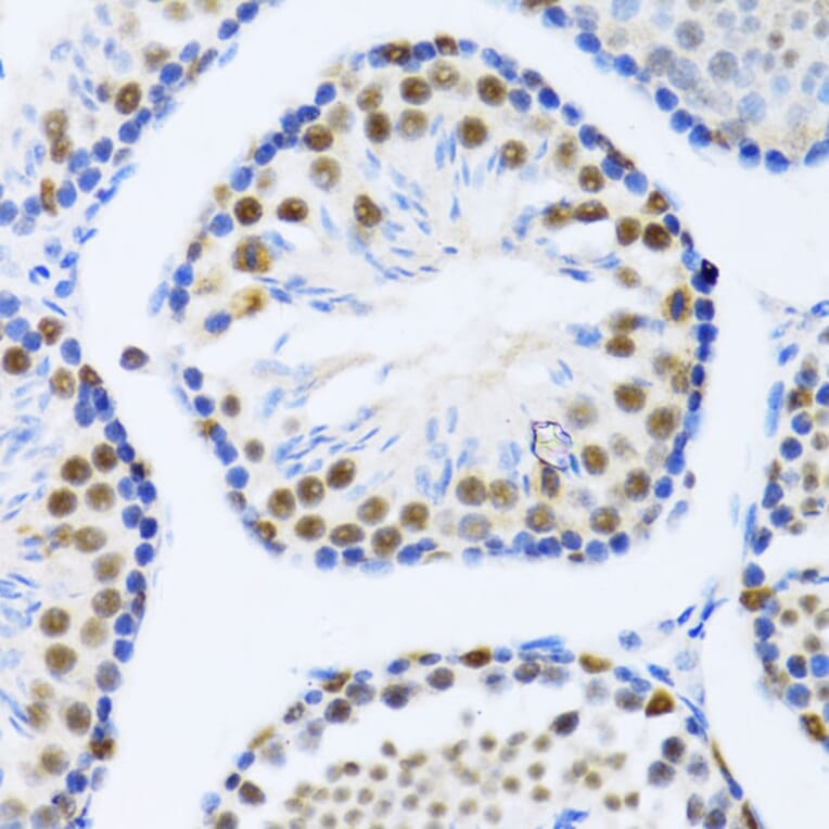 Immunohistochemistry - Anti-DDX46 Antibody (A87987) - Antibodies.com