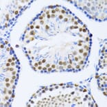 Immunohistochemistry - Anti-DDX46 Antibody (A87987) - Antibodies.com