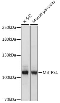 Western blot analysis of extracts of various cell lines, using Anti-MBTPS1 Antibody (A16243) at 1:1,000 dilution.
Secondary antibody: Goat Anti-Rabbit IgG (H+L) (HRP) (AS014) at 1:10,000 dilution.
Lysates / proteins: 25µg per lane.
Blocking buffer: 3% non-fat dry milk in TBST.
Detection: ECL Basic Kit (RM00020).
Exposure time: 1s.