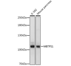 Western Blot - Anti-S1P Antibody (A87988) - Antibodies.com