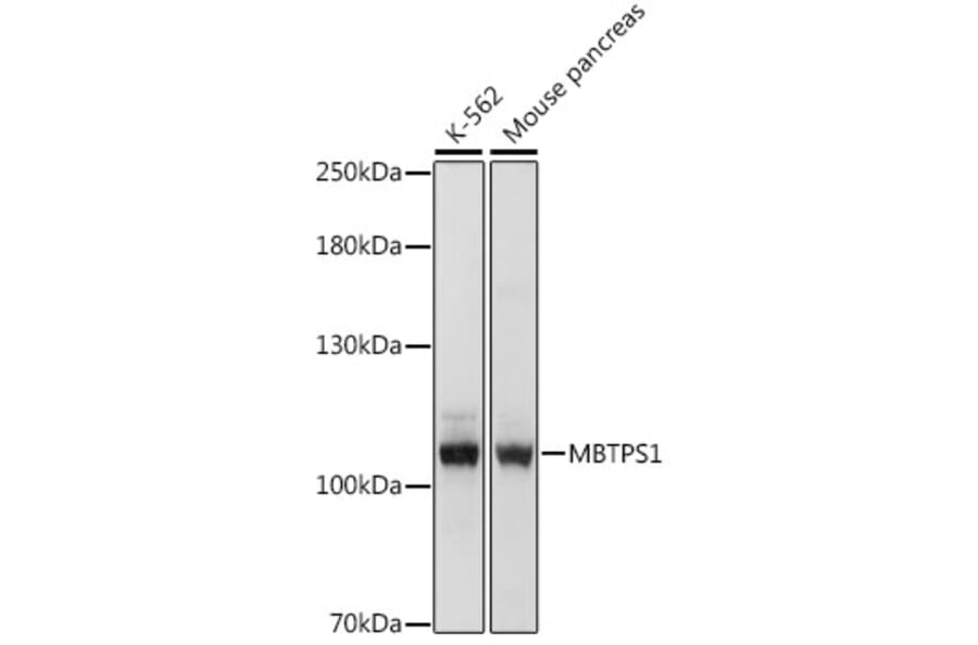 Western Blot - Anti-S1P Antibody (A87988) - Antibodies.com