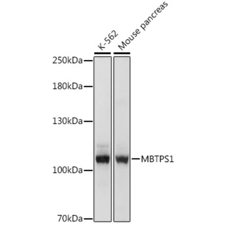Western Blot - Anti-S1P Antibody (A87988) - Antibodies.com