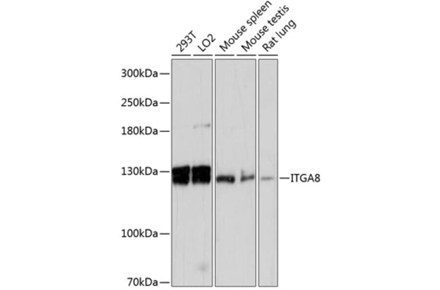 Western Blot - Anti-ITGA8 Antibody (A87989) - Antibodies.com