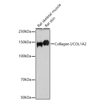 Western Blot - Anti-COL1A2 Antibody (A87990) - Antibodies.com