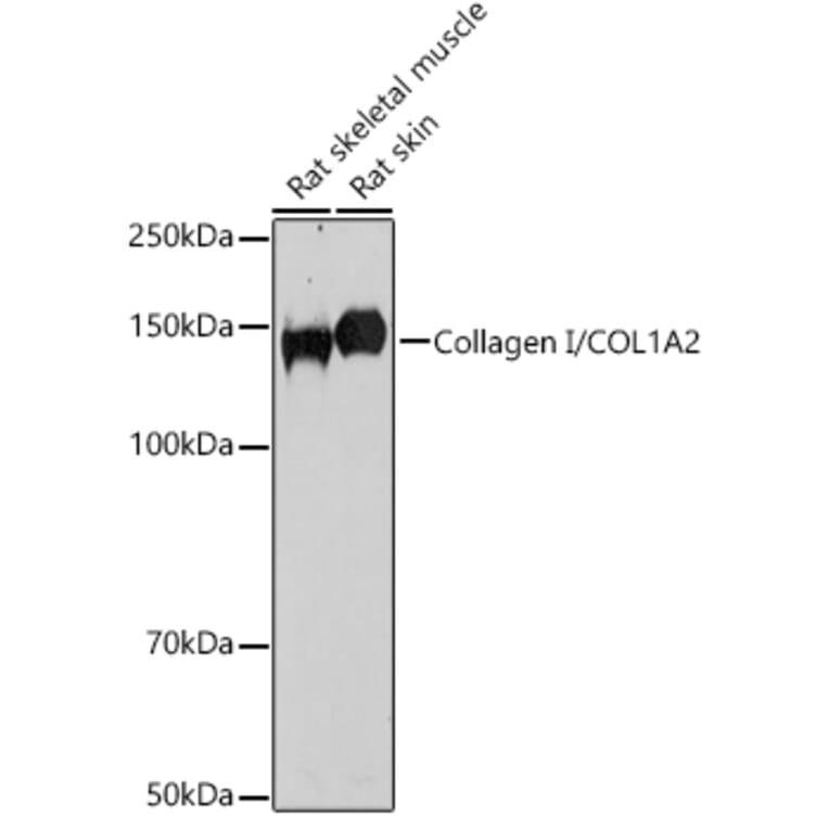 Western Blot - Anti-COL1A2 Antibody (A87990) - Antibodies.com