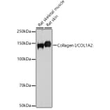 Western Blot - Anti-COL1A2 Antibody (A87990) - Antibodies.com