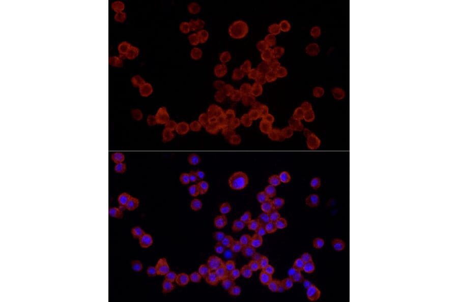 Immunofluorescence - Anti-NLRP3 Antibody (A87991) - Antibodies.com
