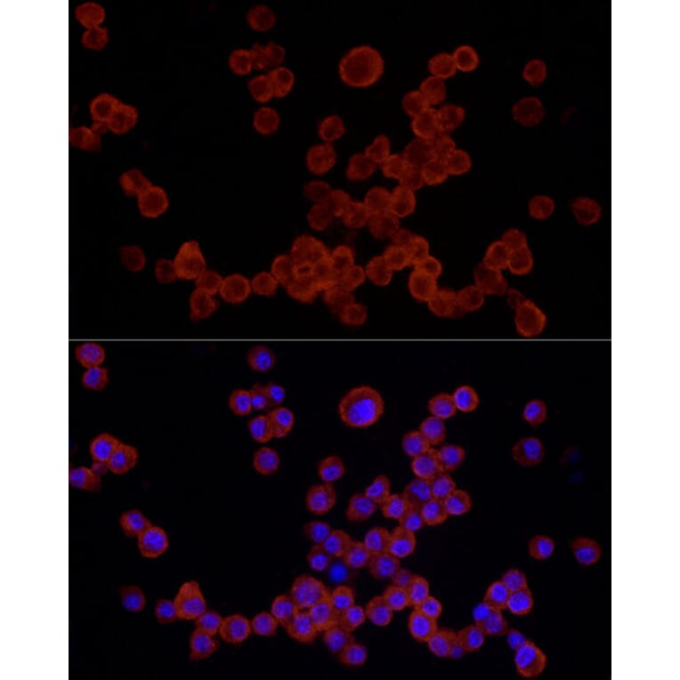 Immunofluorescence - Anti-NLRP3 Antibody (A87991) - Antibodies.com