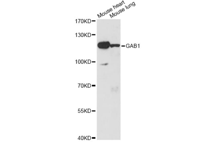 Western Blot - Anti-GAB1 Antibody (A14534) - Antibodies.com
