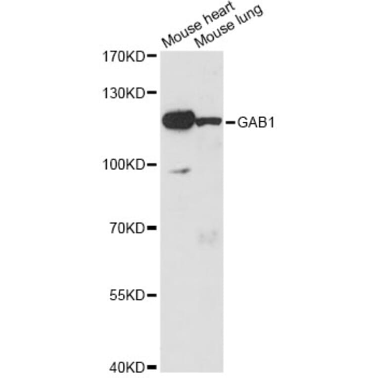 Western Blot - Anti-GAB1 Antibody (A14534) - Antibodies.com