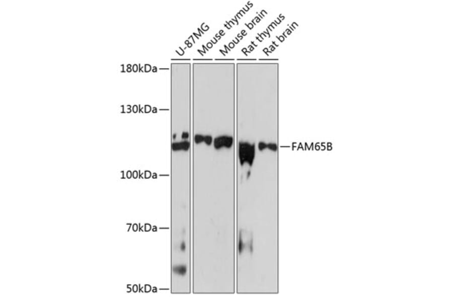 Western Blot - Anti-FAM65B Antibody (A87993) - Antibodies.com