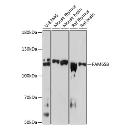 Western Blot - Anti-FAM65B Antibody (A87993) - Antibodies.com