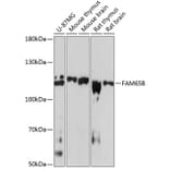 Western Blot - Anti-FAM65B Antibody (A87993) - Antibodies.com