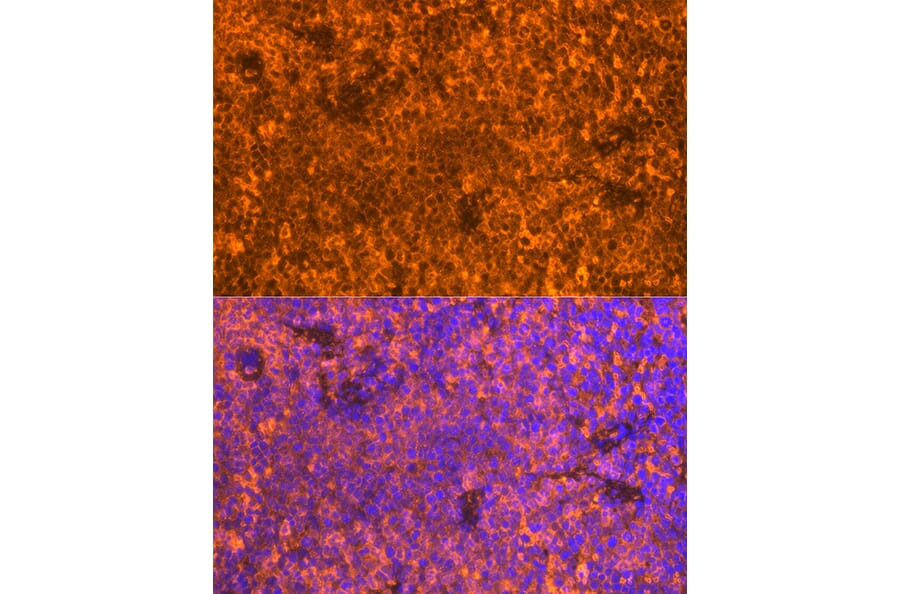 Immunofluorescence - Anti-FAM65B Antibody (A87993) - Antibodies.com