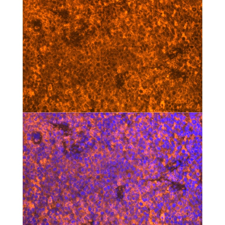 Immunofluorescence - Anti-FAM65B Antibody (A87993) - Antibodies.com