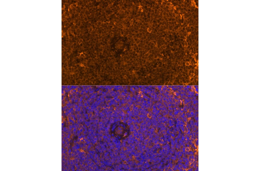 Immunofluorescence - Anti-FAM65B Antibody (A87993) - Antibodies.com