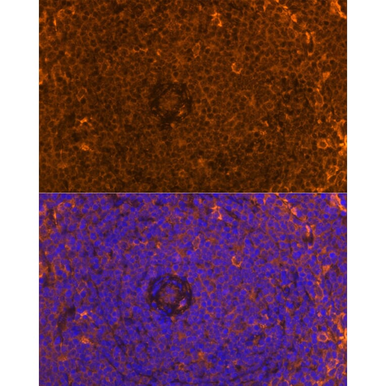 Immunofluorescence - Anti-FAM65B Antibody (A87993) - Antibodies.com