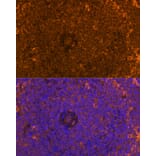 Immunofluorescence - Anti-FAM65B Antibody (A87993) - Antibodies.com