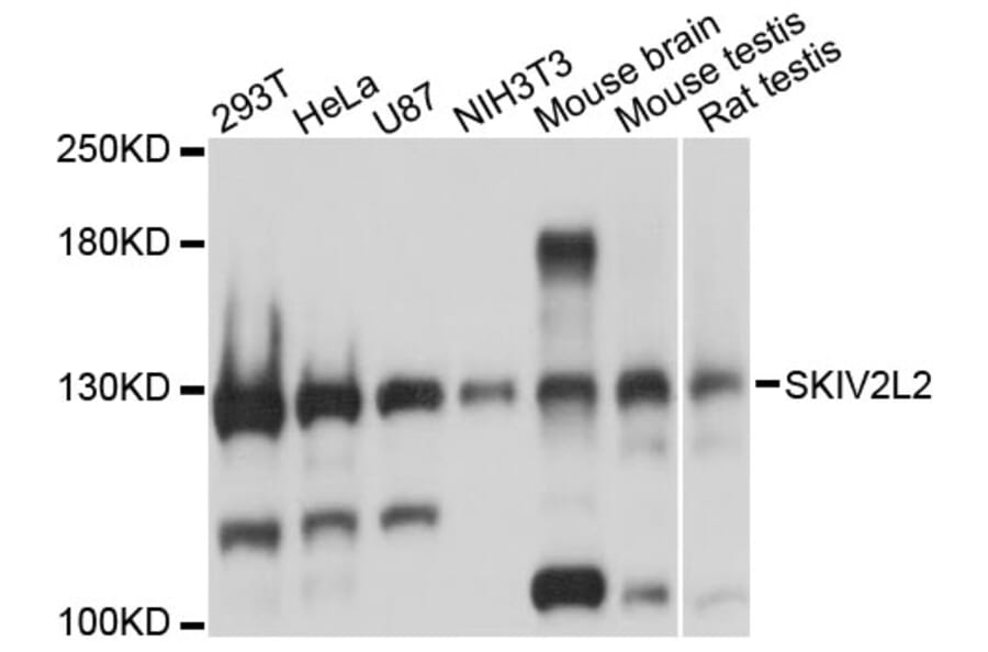 Western Blot - Anti-SKIV2L2 Antibody (A13258) - Antibodies.com