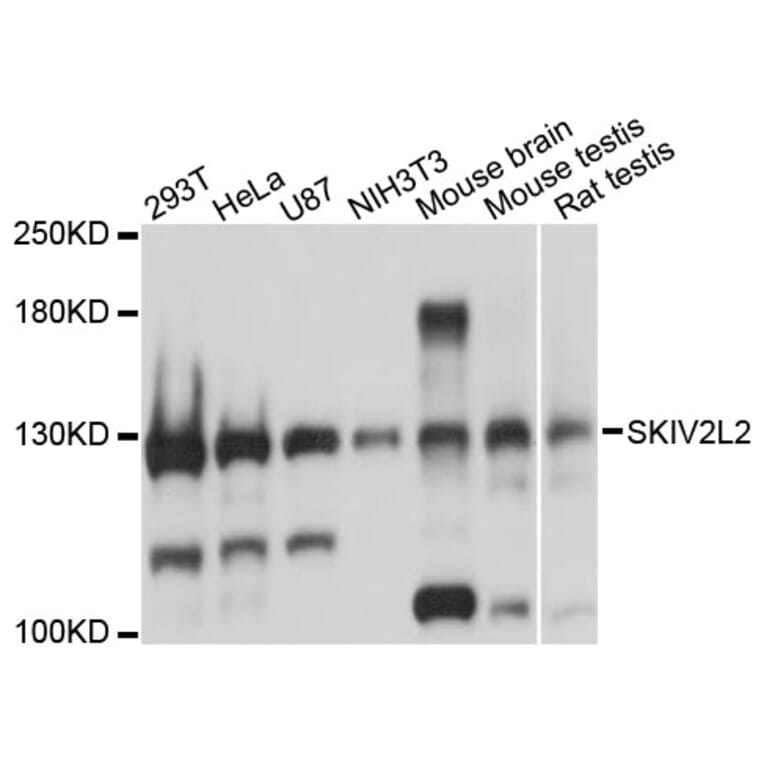 Western Blot - Anti-SKIV2L2 Antibody (A13258) - Antibodies.com