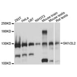 Western Blot - Anti-SKIV2L2 Antibody (A13258) - Antibodies.com