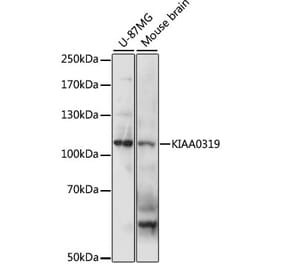 Western Blot - Anti-KIAA0319 Antibody (A87995) - Antibodies.com