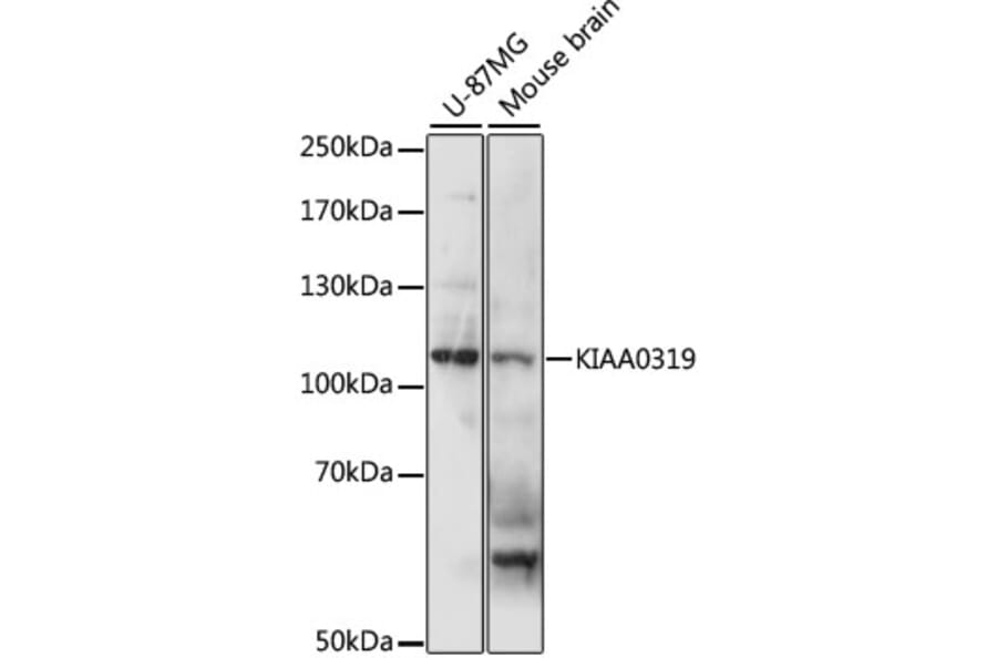 Western Blot - Anti-KIAA0319 Antibody (A87995) - Antibodies.com