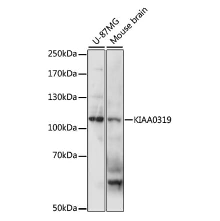 Western Blot - Anti-KIAA0319 Antibody (A87995) - Antibodies.com