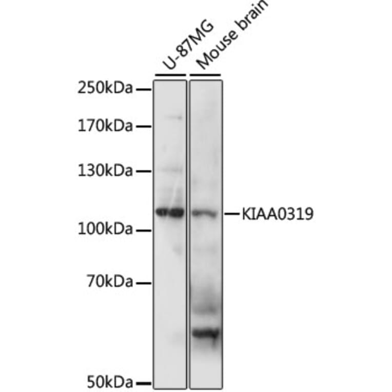 Western Blot - Anti-KIAA0319 Antibody (A87995) - Antibodies.com