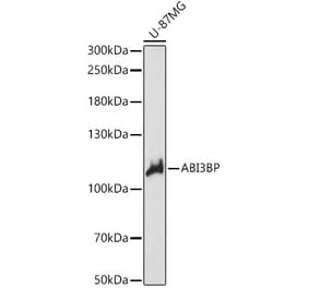 Western Blot - Anti-ABI3BP Antibody (A87996) - Antibodies.com