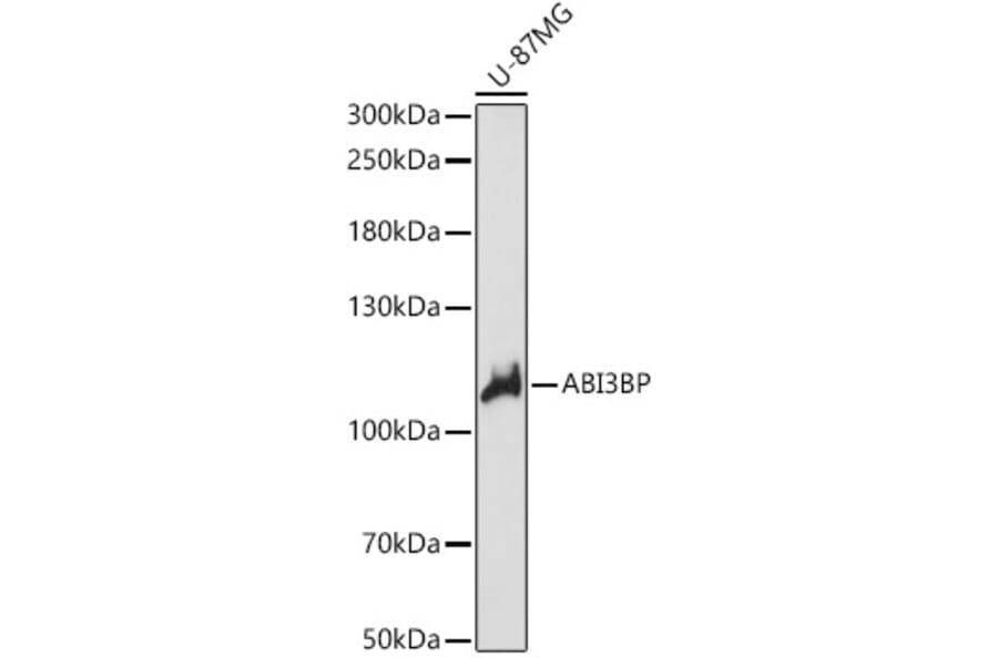 Western Blot - Anti-ABI3BP Antibody (A87996) - Antibodies.com