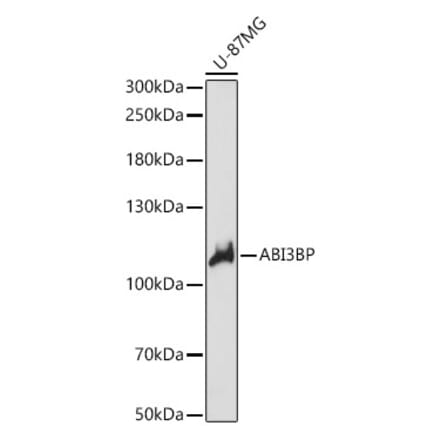 Western Blot - Anti-ABI3BP Antibody (A87996) - Antibodies.com