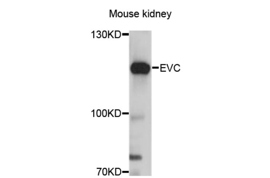 Western Blot - Anti-EVC Antibody (A12635) - Antibodies.com