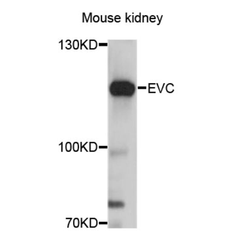 Western Blot - Anti-EVC Antibody (A12635) - Antibodies.com