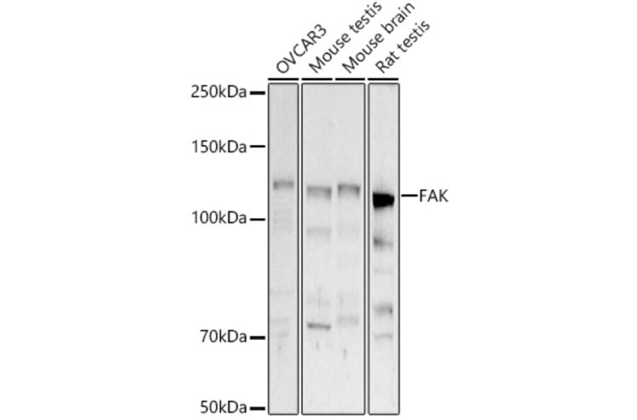 Western Blot - Anti-FAK Antibody (A88000) - Antibodies.com