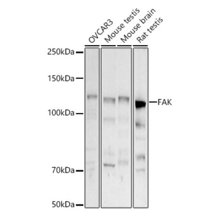 Western Blot - Anti-FAK Antibody (A88000) - Antibodies.com