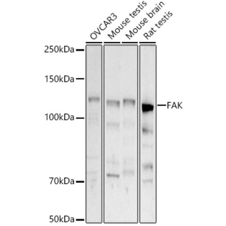 Western Blot - Anti-FAK Antibody (A88000) - Antibodies.com